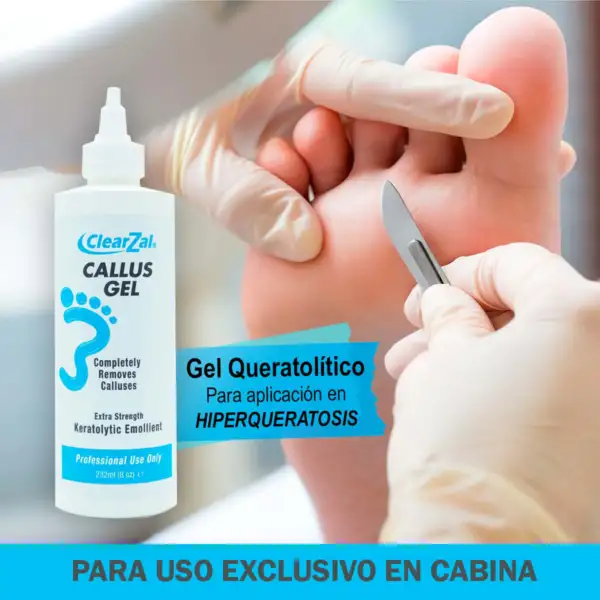 CALLUS GEL - Imagen 2