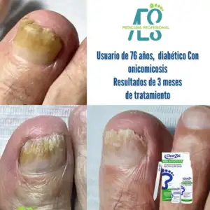 FOTO13