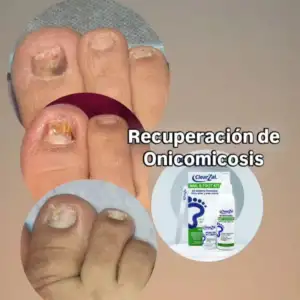 FOTO14