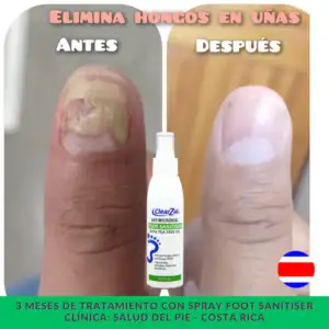 FOTO3