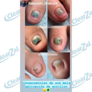 FOTO31