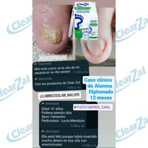 FOTO32