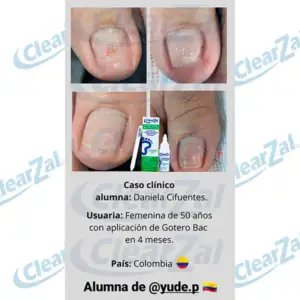 FOTO33