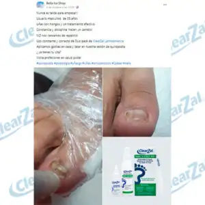 FOTO37