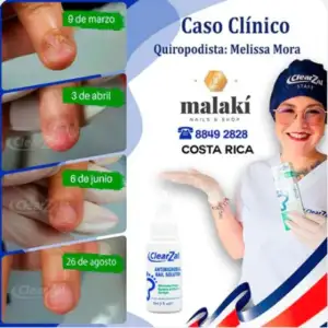 FOTO39