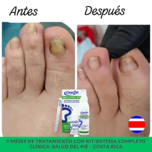FOTO6